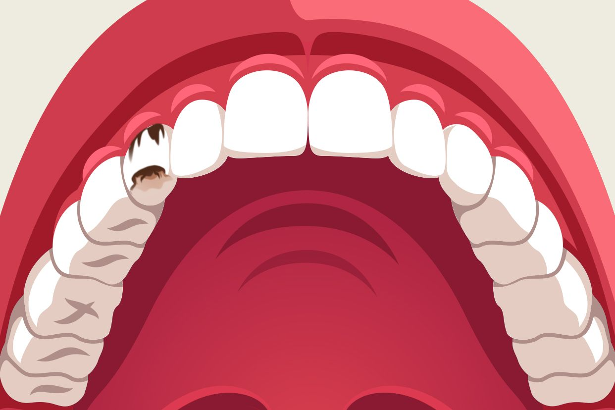 尖牙蛀牙图片 尖牙蛀牙图片