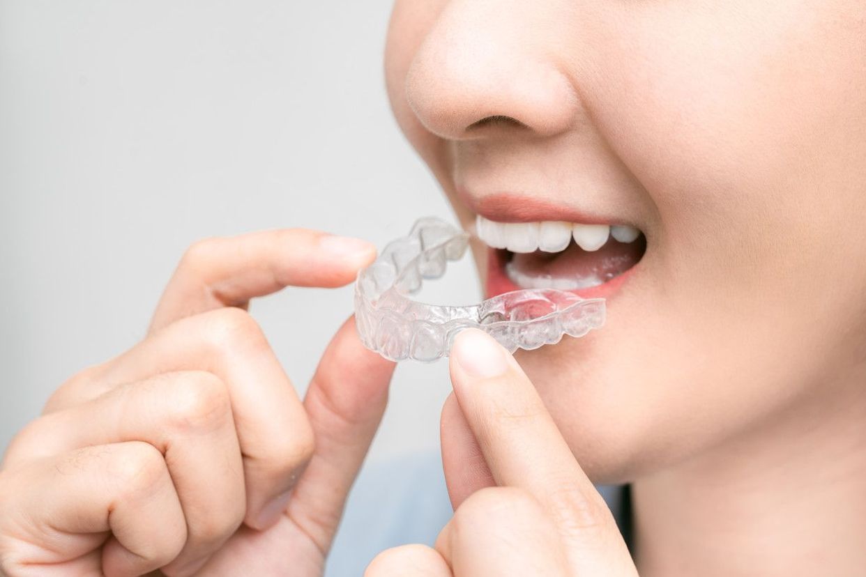 牙釉质透明照片 牙釉质透明照片高清