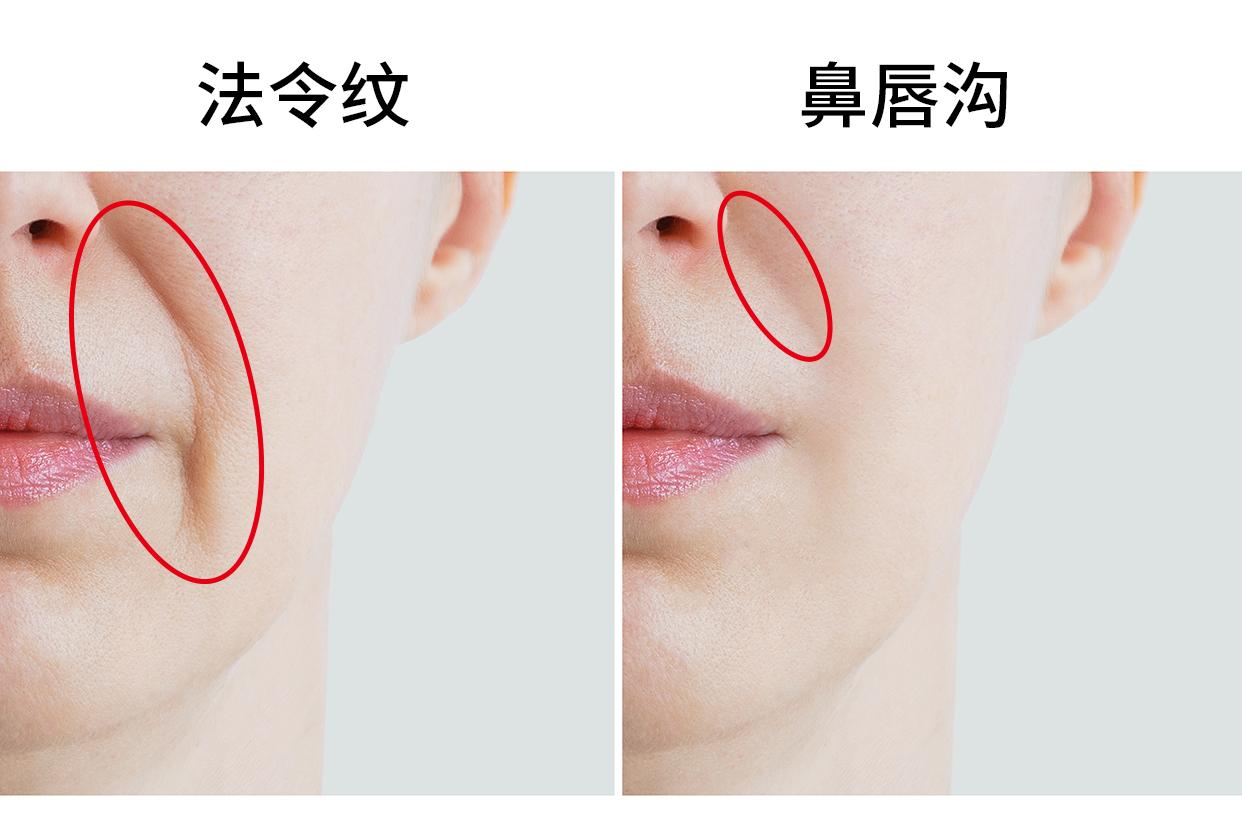 法令纹和鼻唇沟的区别图片 法令纹鼻唇沟在面部哪个部位