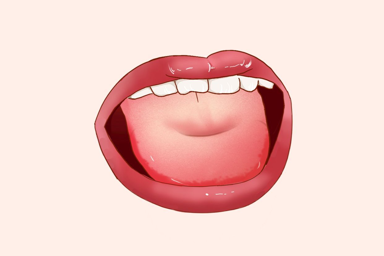 痿软舌图片