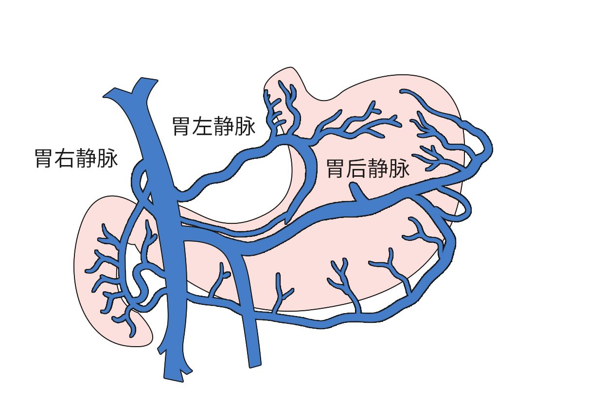 胃血管解剖图高清图