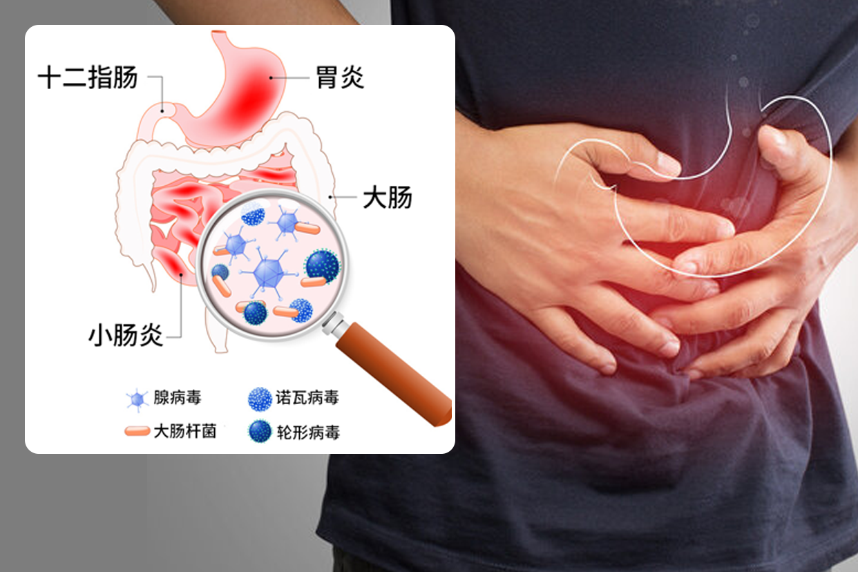 急性胃炎图片