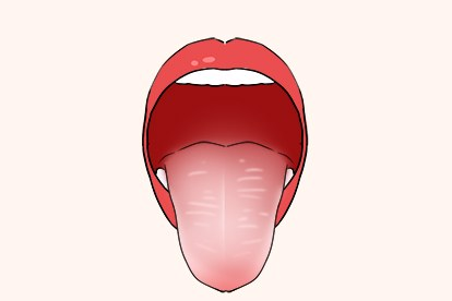 舌红苔白图片