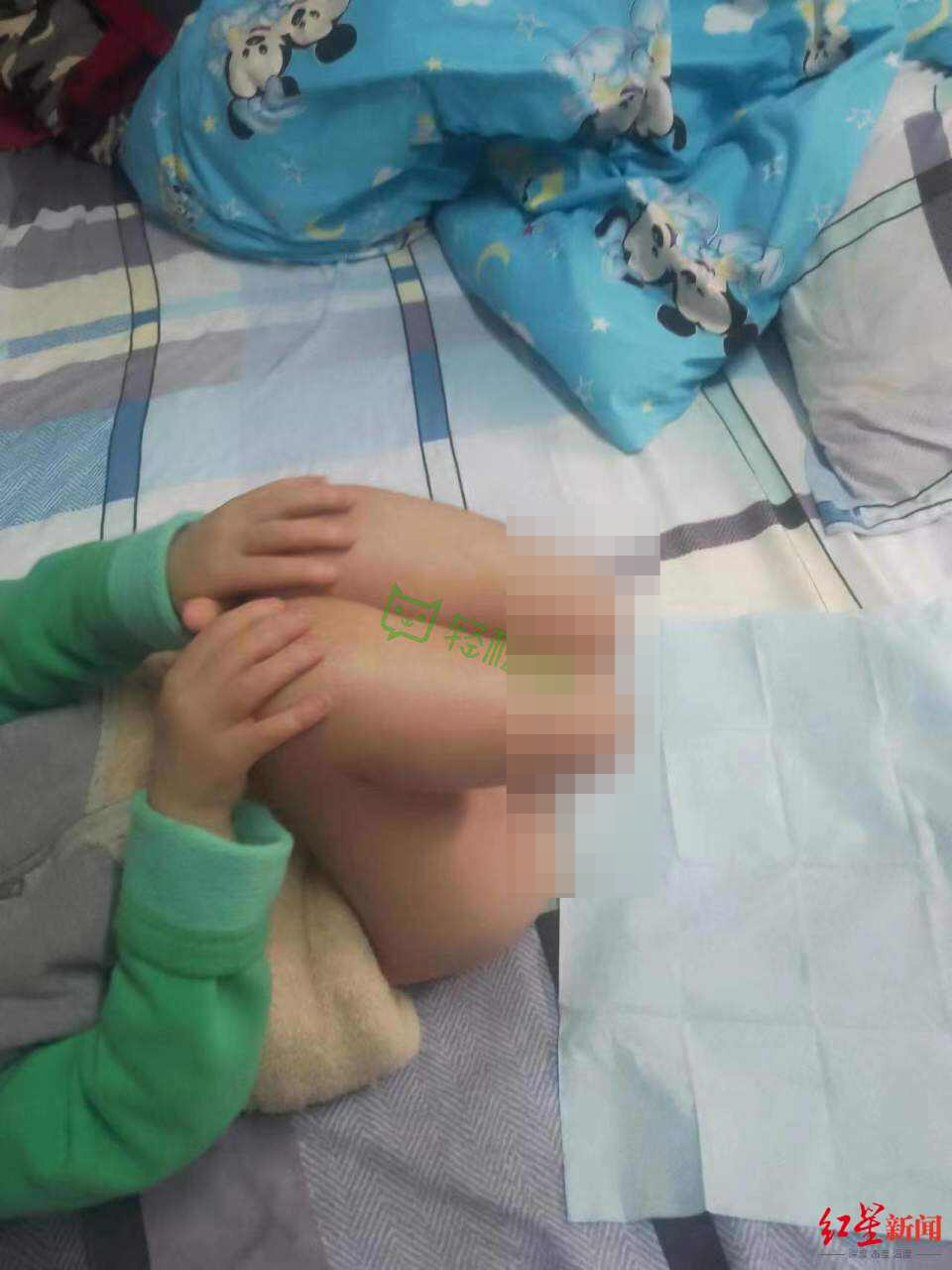 江苏5岁男童被生母虐待致双腿截肢，对话父亲：和妻子是离婚再复婚，之前只觉她脾气急躁
