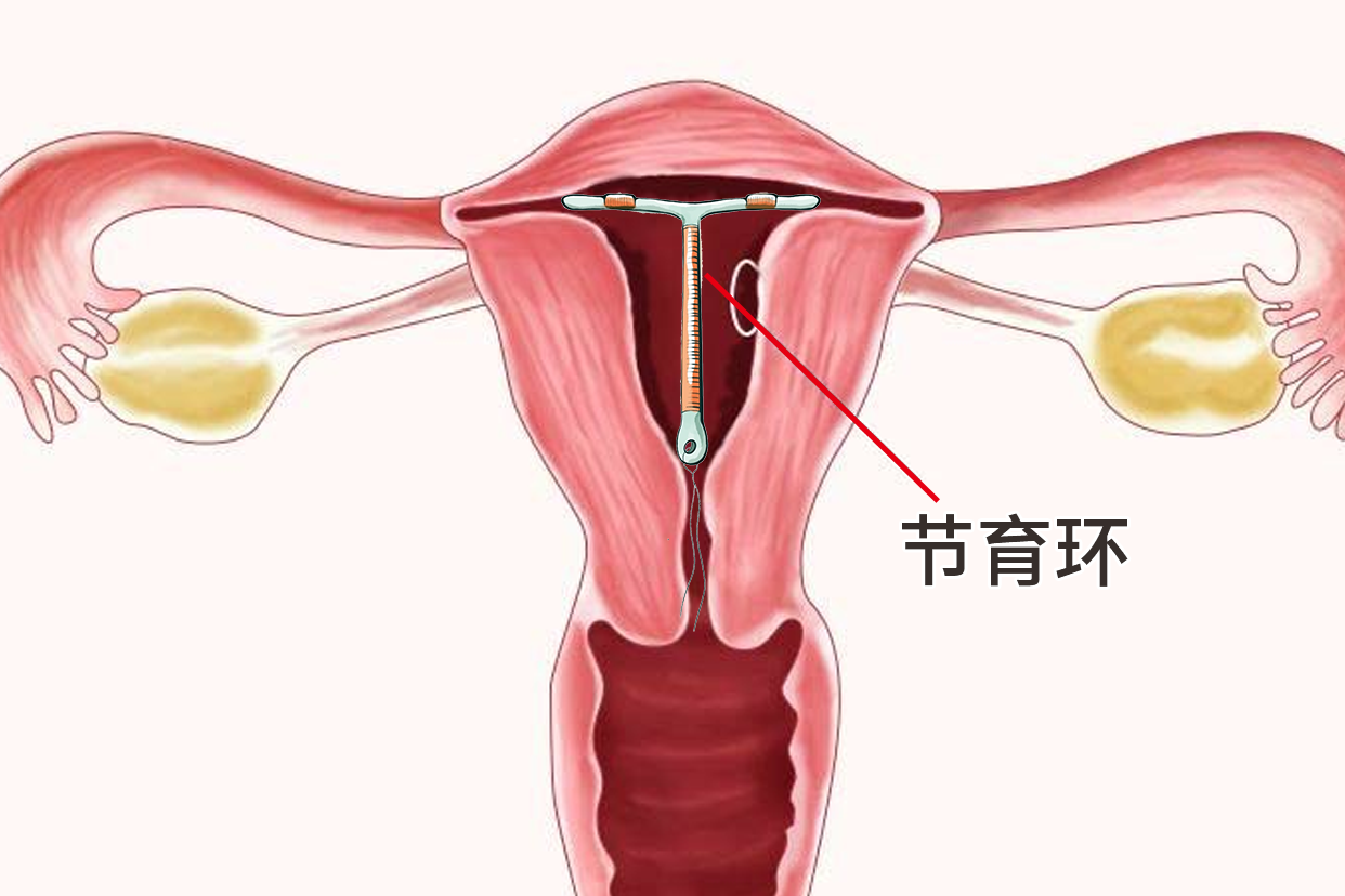 有女人上怀的子宫图片吗 女人上怀是啥意思