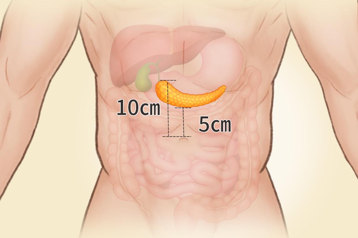 人体胰腺位置、结构图（人体胰腺位置图片大全）