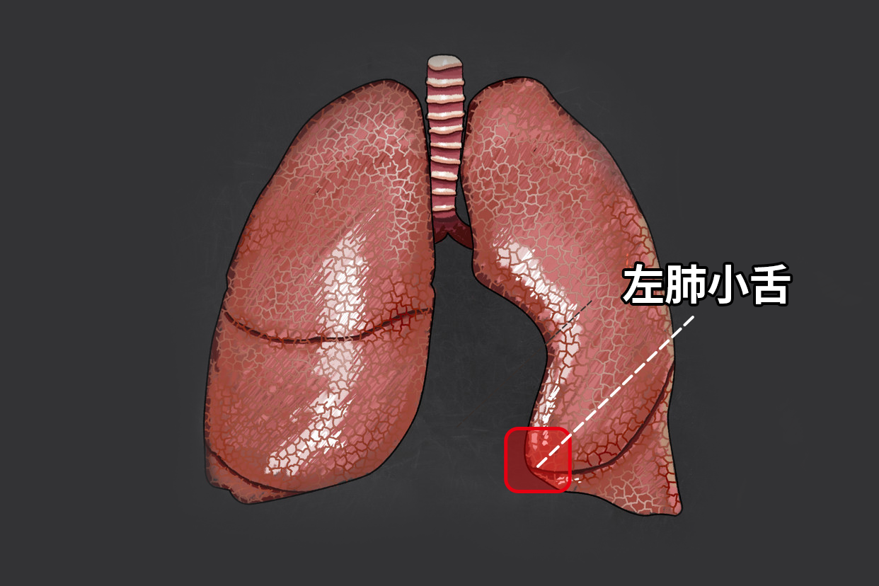 左肺小舌图片（左肺小舌解剖图）
