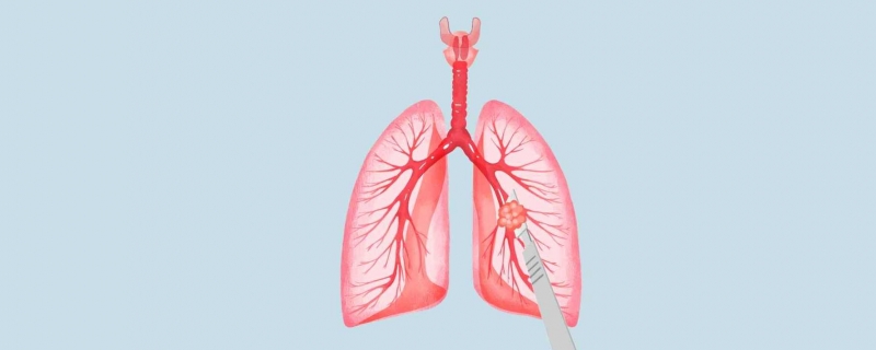 甲流引起白肺原因